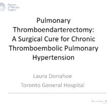 2018-10-02 Pulmonary Thomboendarterectomy - Donahoe