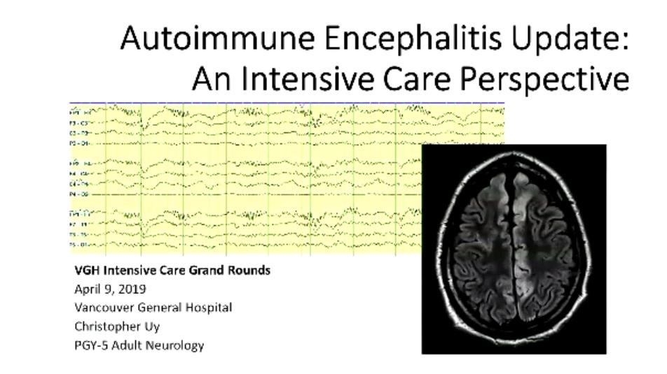 2019-04-09 Autoimmune Encephalitis Update - Uy